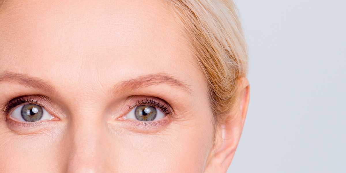 DFWPlasticSurgery Internal blepharoplasty